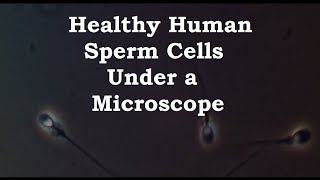 Healthy Human Sperm Cells Under a Microscope [upl. by Ahsinoj]