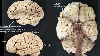 Lateral sulcus [upl. by Nagiem]