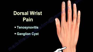 Ulnar Sided Wrist Pain 2 Kinesiology Taping Technique [upl. by Cousins]