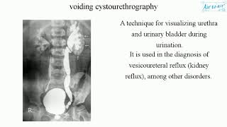 Bladder Trauma  Diagnosis [upl. by Lexine]