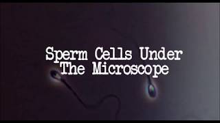 What Are Sperm Cells Sperm Under The Microscope [upl. by Rondon]