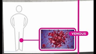 Venous Thrombosis Explained [upl. by Bigford]