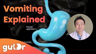 What Happens During Vomiting  The GutDr Explains 3D Gut Animation [upl. by Zena]