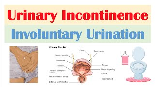 Urinary Tract Infection In Women  Causes amp Treatment [upl. by Cristie]