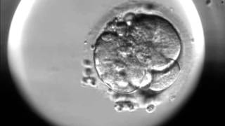 Timelapse of fertilisation of a human egg under the microscope [upl. by Nachison]