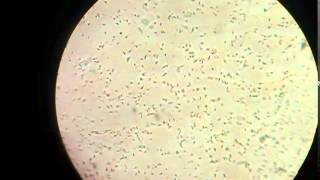 Sperm cells in microscope [upl. by Alimak639]