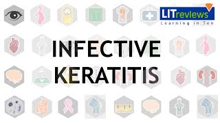 Infective Keratitis [upl. by Llehsyar694]