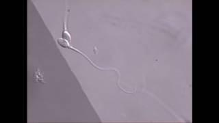 Sperm swimming in microscope field [upl. by Karwan]