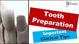 CLINICAL TIPS for TOOTH PREPARATIONCROWN PREPARATION [upl. by Durarte256]