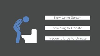 What Are the Signs of Bladder Cancer [upl. by Hermon]