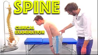 Spine Examination  Back Pain Assessment  4K  Clinical Skills  Dr Gill [upl. by Nollad]