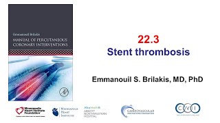 223 Stent Thrombosis Manual of PCI [upl. by Tila]