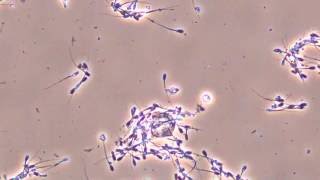 Moving pig sperm observed by biological [upl. by Prissy]